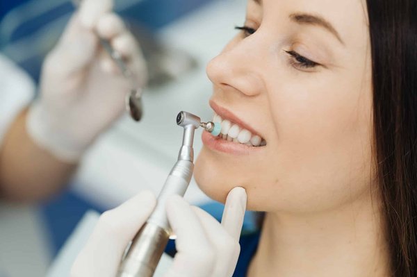 Comment prévenir les caries à Mascouche ?